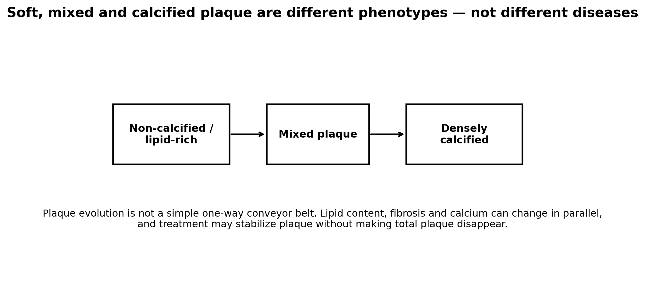 Diagram showing coronary plaque composition on a continuum from non-calcified lipid-rich plaque through mixed plaque to dense calcified plaque.